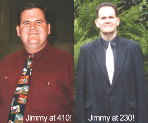 jimmybeforeafter