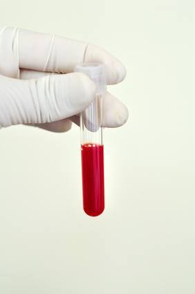 Blood sample